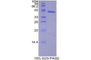 SDS-PAGE analysis of Human Lipocalin 12 Protein. (LCN12 Protein)