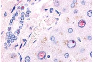 Immunohistochemistry (IHC) image for anti-Nuclear Receptor Subfamily 2, Group F, Member 6 (NR2F6) (Ligand Binding Domain) antibody (ABIN1049138)