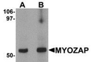 Western blot analysis of MYOZAP in rat kidney tissue lysate with MYOZAP antibody at (A) 1 and (B) 2 μg/ml. (MYZAP Antikörper  (C-Term))