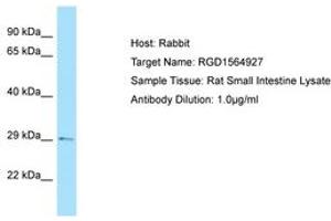 Image no. 1 for anti-TGFB-Induced Factor Homeobox 2 (TGIF2) (C-Term) antibody (ABIN6749857) (TGIF2 Antikörper  (C-Term))