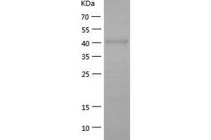 Western Blotting (WB) image for Autophagy related 4A Cysteine Peptidase (ATG4A) (AA 1-398) protein (His tag) (ABIN7121951) (ATG4A Protein (AA 1-398) (His tag))