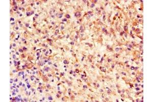 Immunohistochemistry (IHC) image for anti-Nestin (NES) antibody (ABIN7161178)