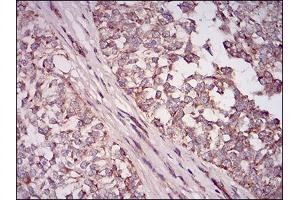 Immunohistochemistry (IHC) image for anti-5'-Nucleotidase, Ecto (CD73) (NT5E) (AA 30-250) antibody (ABIN1724945)