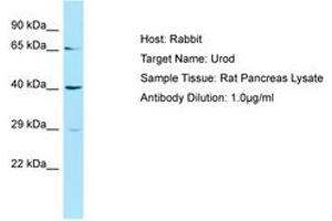 Image no. 1 for anti-Uroporphyrinogen Decarboxylase (UROD) (AA 51-100) antibody (ABIN6749872)