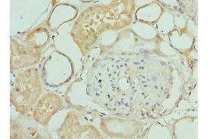 Immunohistochemistry of paraffin-embedded human kidney tissue using ABIN7156393 at dilution of 1:100 (INTS1 Antikörper  (AA 451-710))