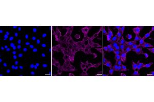 anti-Lysophosphatidic Acid Receptor 1 (LPAR1) antibody