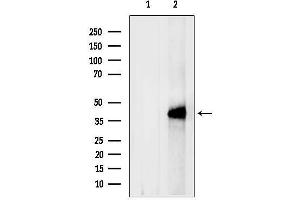 anti-Chemokine (C-X-C Motif) Receptor 5 (CXCR5) (N-Term) antibody