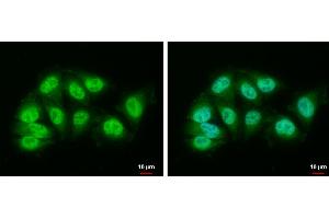 ICC/IF Image DDB1 antibody [N1N3] detects DDB1 protein at nucleus and cytoplasm by immunofluorescent analysis. (DDB1 Antikörper)