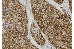 ABIN6278391 at 1/100 staining Human pancreas tissue by IHC-P.