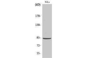 Western Blotting (WB) image for anti-Catenin, beta (CATNB) (Ser29) antibody (ABIN6282883)