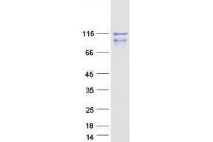 Western Blotting (WB) image for WW Domain Containing E3 Ubiquitin Protein Ligase 2 (WWP2) (Transcript Variant 2) protein (Myc-DYKDDDDK Tag) (ABIN2735648)