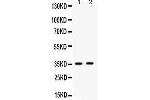 Western blot analysis of Apolipoprotein E expression in mouse spleen extract ( Lane 1) and mouse kidney extract ( Lane 2). (APOE Antikörper  (AA 55-294))