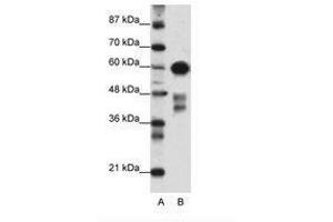 Image no. 1 for anti-Zinc Finger and SCAN Domain Containing 5A (AA 301-350) antibody (ABIN6736156) (ZSCAN5A Antikörper  (AA 301-350))