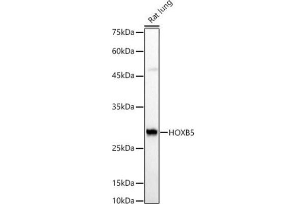 HOXB5 Antikörper  (AA 1-170)