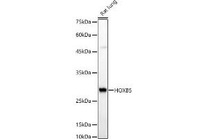 Western blot analysis of extracts of Rat lung, using HOXB5 antibody (ABIN7267769) at 1:510 dilution. (HOXB5 Antikörper  (AA 1-170))