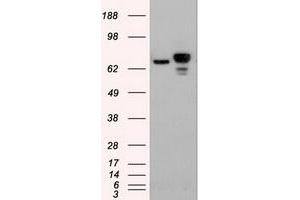 HEK293T cells were transfected with the pCMV6-ENTRY control (Left lane) or pCMV6-ENTRY CTNNB1 (RC208947) (Right lane) cDNA for 48 hrs and lysed. (CTNNB1 Antikörper  (AA 531-781))