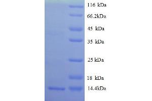 SDS-PAGE (SDS) image for C-X-C Motif Chemokine 14 (CXL14) (AA 23-99) protein (His tag) (ABIN5712678)