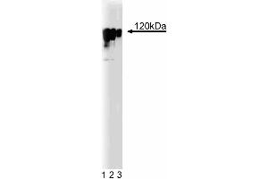 Western blot analysis of Eg5 on a human endothelial cell lysate. (KIF11 Antikörper  (AA 324-532))