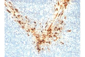 Immunohistochemistry (IHC) image for anti-Mesothelin (MSLN) (AA 273-407) antibody (ABIN6939032)