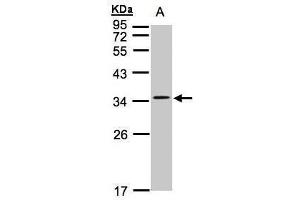 WB Image Sample(30 ug whole cell lysate) A:Hep G2 , 12% SDS PAGE antibody diluted at 1:1000 (CACNG5 Antikörper  (Center))