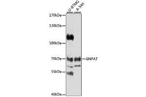 Western blot analysis of extracts of various cell lines, using GNPAT antibody (ABIN1872854) at 1:1000 dilution. (GNPAT Antikörper)
