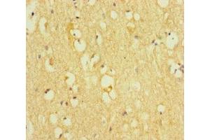 Immunohistochemistry of paraffin-embedded human brain tissue using ABIN7172313 at dilution of 1:100