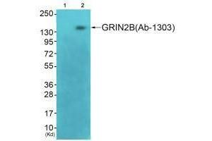 Western blot analysis of extracts from 3T3 cells (Lane 2), using GRIN2B (Ab-1303) antiobdy. (GRIN2B Antikörper  (Ser1303))