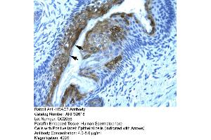Human Spermatophore (HDAC2 Antikörper  (C-Term))