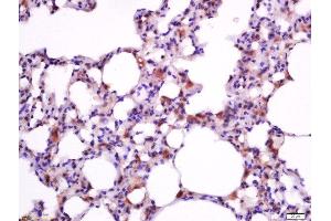 Immunohistochemistry (Paraffin-embedded Sections) (IHC (p)) image for anti-BCL2-Associated X Protein (BAX) (AA 84-175) antibody (ABIN725390)