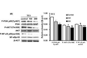 Qigesan inhibits PI3K/AKT and NF-κB signaling pathwayEca109 and TE1 cells were treated with QGS (0, 100, and 200 μg/mL) for 24 h. (AKT1 Antikörper  (pThr308))