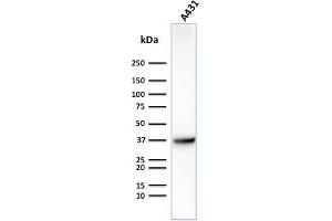 Western Blot Analysis of Human A431 cell lysate using GLUT-1 Mouse Monoclonal Antibody (GLUT1/2475). (GLUT1 Antikörper  (AA 203-305))