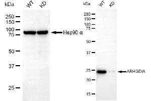 Western blotting analysis using ARHGDIA antibody (ABIN7800195).