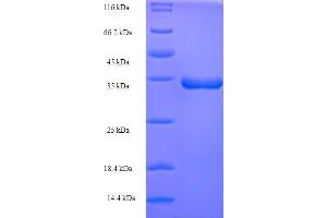 SDS-PAGE (SDS) image for Cardiotrophin 1 (CTF1) (AA 19-176) protein (His-SUMO Tag) (ABIN5711553)