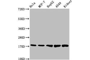 Western Blot Positive WB detected in: Hela whole cell lysate, MCF-7 whole cell lysate, HepG2 whole cell lysate, A549 whole cell lysate, Mouse kidney tissue All lanes: PBR antibody at 1.