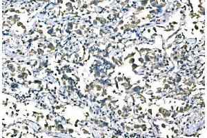 IHC analysis of B Raf/BRAF using anti-B Raf/BRAF antibody (ABIN3043761). (BRAF Antikörper  (AA 38-230))