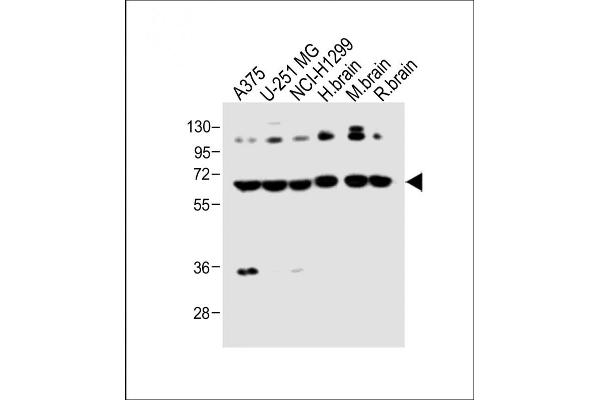 DLL3 Antikörper  (C-Term)