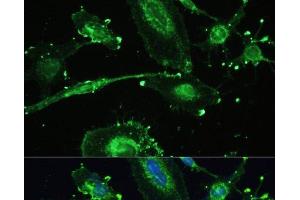 Immunofluorescence analysis of U-251MG cells using TREM2 Polyclonal Antibody at dilution of 1:100. (TREM2 Antikörper)