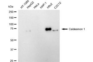 Western blotting analysis using caldesmon 1 antibody (ABIN7797840). (Rekombinanter Caldesmon Antikörper)