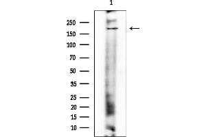 Western blot analysis of lysates from COLO205 cells(heat-shock treatment), using Phospho-TOP2A (Ser1469) Antibody at 1/1000 dilution.