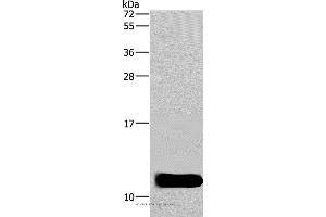 Western blot analysis of Mouse brain tissue, using DYNLL1 Polyclonal Antibody at dilution of 1:600