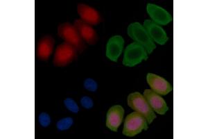 Phospho-CRTC3 (Ser162) Antibody staining Hela cells(45 min of heat-shock treatment) by IF/ICC. (CRTC3 Antikörper  (pSer162))