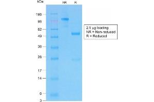 SDS-PAGE Analysis of Purifed CFTR Rabbit Recombinant Monoclonal Antibody (CFTR/1775R). (Rekombinanter CFTR Antikörper  (AA 258-385))