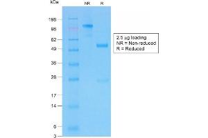 SDS-PAGE (SDS) image for anti-Cystic Fibrosis Transmembrane Conductance Regulator (ATP-Binding Cassette Sub-Family C, Member 7) (CFTR) (AA 258-385) antibody (ABIN6939095)