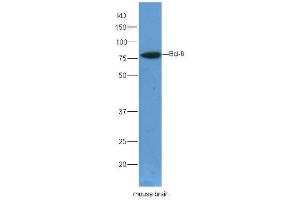 Lane 1:mouse brain lysates probed with Rabbit Anti-Bcl6 Polyclonal Antibody, Unconjugated  at 1:5000 for 90 min at 37˚C. (BCL6 Antikörper  (AA 501-600))