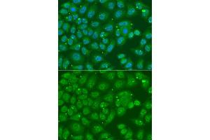 Immunofluorescence analysis of A549 cell using ANXA8L2 antibody. (ANXA8L2 Antikörper)