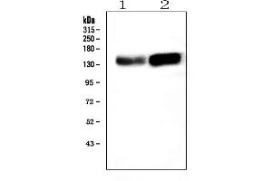 Western blot analysis of ADAMTS13 using anti-ADAMTS13 antibody (ABIN4886425).