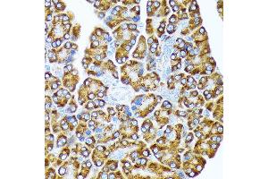 Immunohistochemistry (IHC) image for anti-Eukaryotic Translation Initiation Factor 2A, 65kDa (EIF2A) antibody (ABIN7267035)