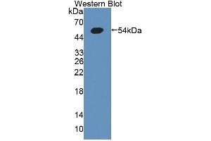 Figure. (GCK Antikörper  (AA 194-410))