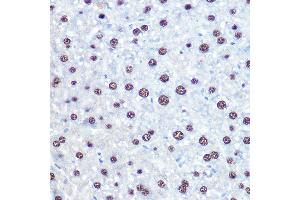 Immunohistochemistry of paraffin-embedded mouse liver using APIP Rabbit pAb (ABIN6131310, ABIN6136985, ABIN6136986 and ABIN6222909) at dilution of 1:100 (40x lens). (APIP Antikörper  (AA 1-242))