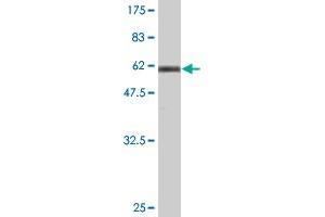 Western Blot detection against Immunogen (66 KDa) . (GKAP1 Antikörper  (AA 1-366))